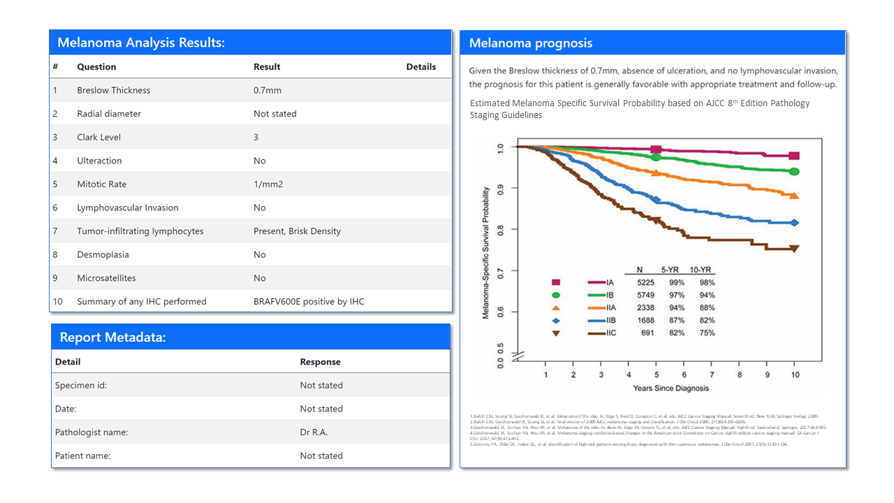 Melanoma prognosis and survival curves